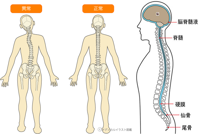 自律神経の乱れは「腸の老化」と「体の歪み」が密接に関係