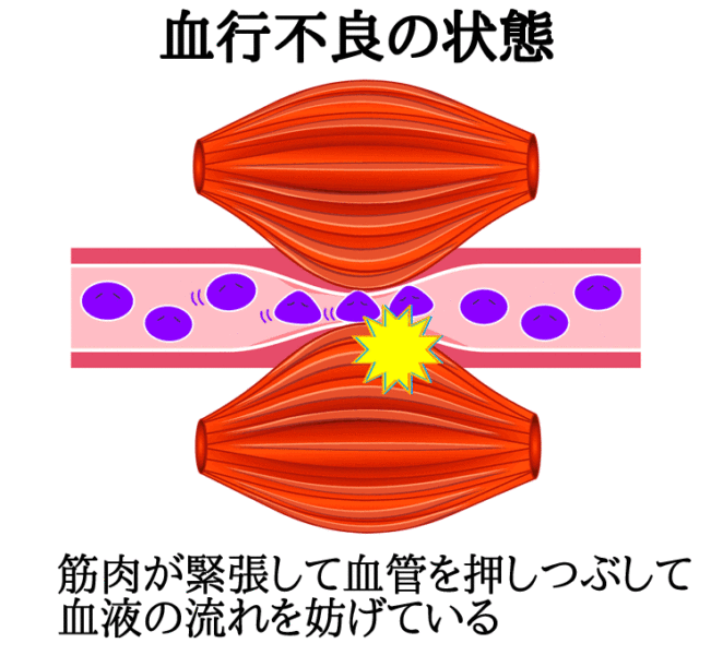 血行不良の状態