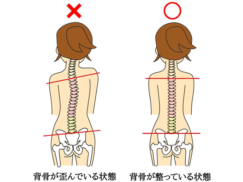 身体の歪み